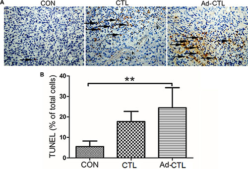 The effect of Ad5/35-TRAIL-CD40L-CTL (Ad-CTL) on pancreatic carcinoma cell apoptosis in vivo.