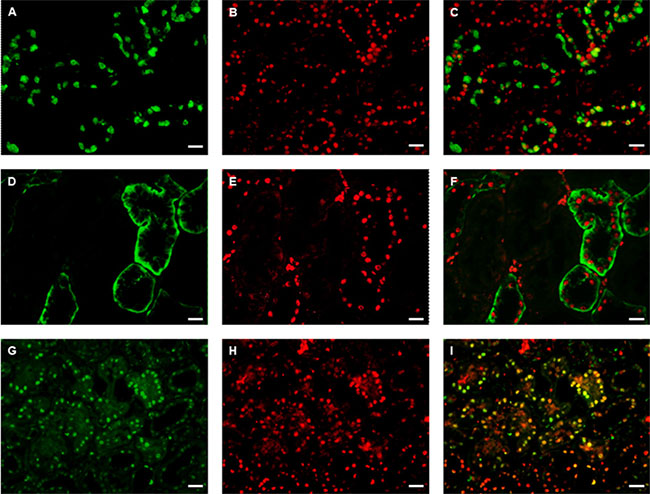 Double immunofluorescence staining for DACH1 and Bax/Bcl-2, PCNA in normal kidney.