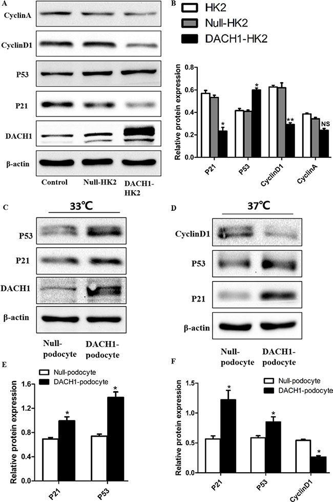 Effects of DACH1 overexpression on cell cycle-related proteins in HK2 and Podocytes.
