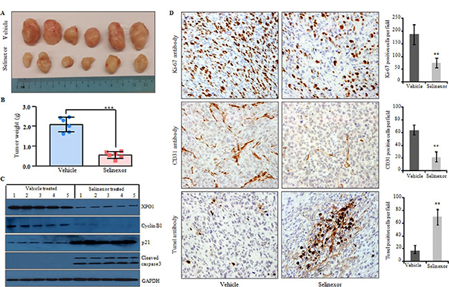 Selinexor significantly reduced tumor growth of LPS141 cells in a xenograft murine model.