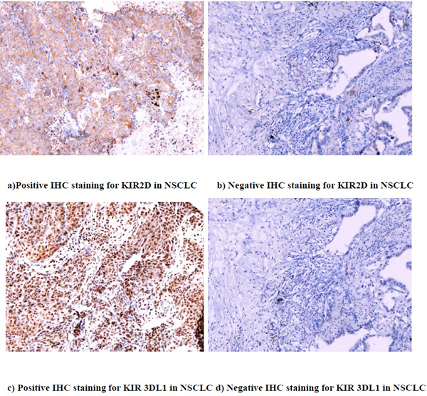 IHC staining for KIR 2D (L1, L3, L4, S4) and KIR 3DL1 (20X)