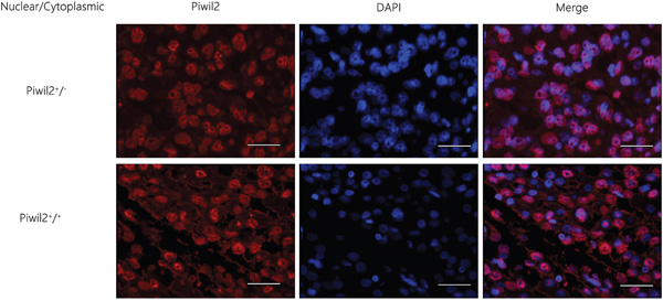 Immunofluorescence staining results of the localization and expression of a single marker Piwil2 in HCC tissues.
