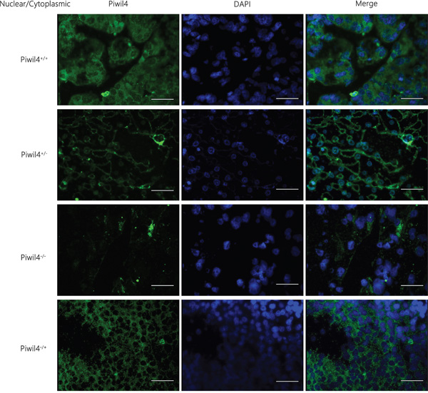 Immunofluorescence staining results of the localization and expression of a single marker Piwil4 in HCC tissues.