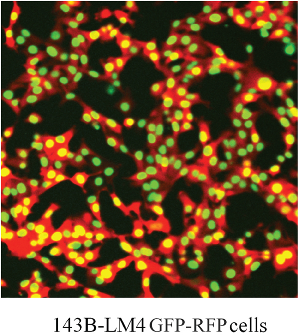 Dual-color 143B-LM4 human osteosarcoma cells expressing GFP in the nucleus and RFP in the cytoplasm in vitro.