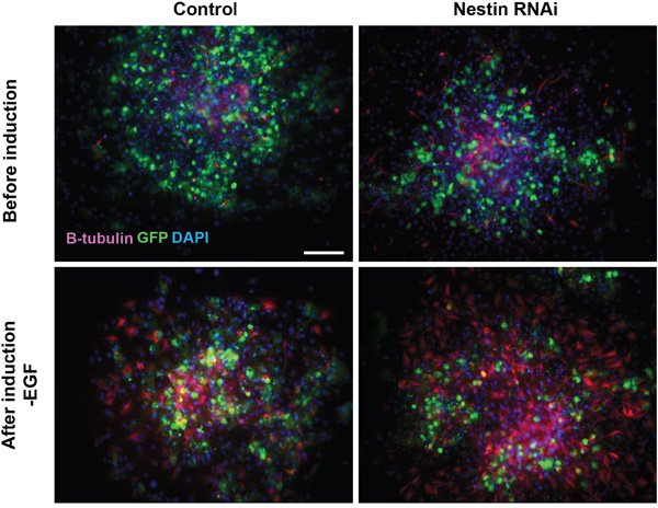 Nestin knockdown promote neuronal differentiation of NPCs.