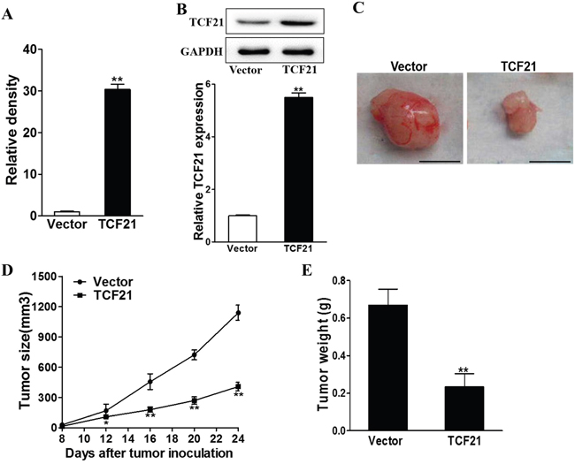 TCF21 suppresses tumor growth.