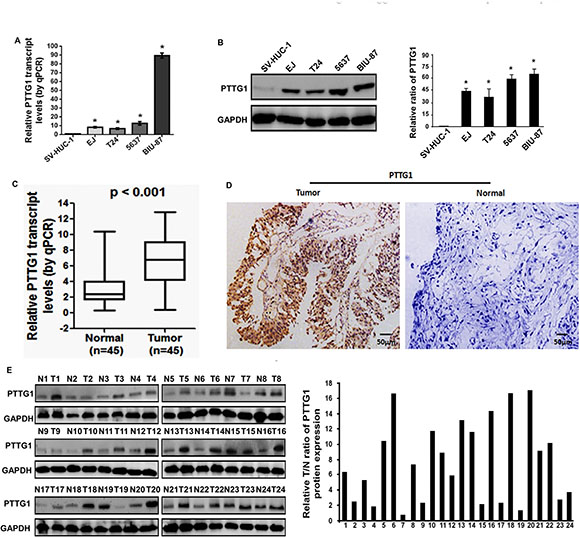 PTTG1 was overexpressed in BC tissues and cell lines.