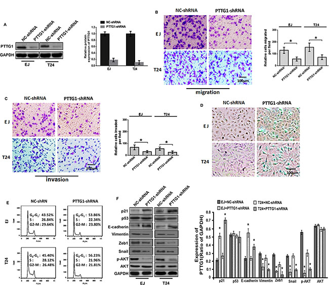 PTTG1 knockdown inhibited migration and invasion and induced cell cycle arrest and senescence.