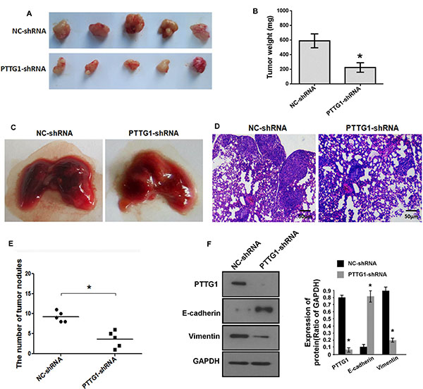 PTTG1 knockdown inhibited BC growth and metastasis in vivo.