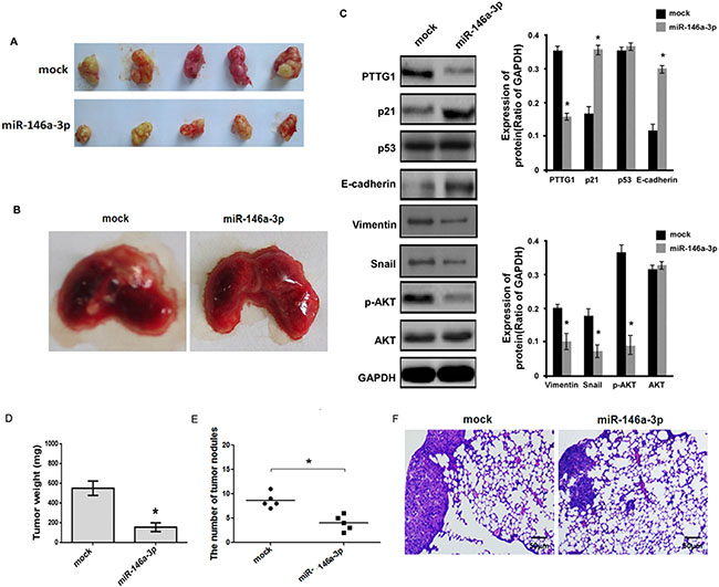 miR-146a-3p inhibited the growth and metastasis of BC cells in vivo.