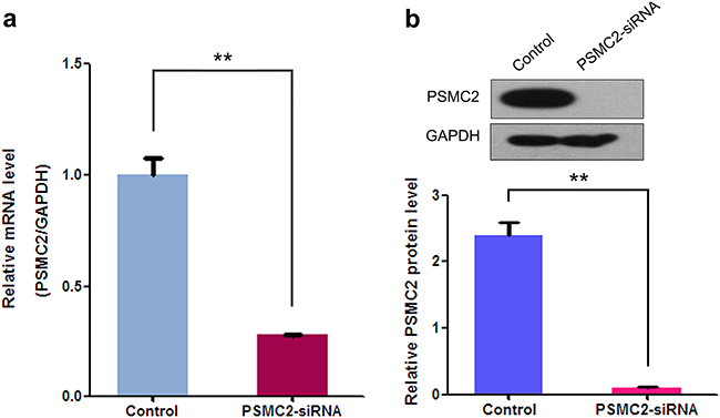 Effects of siRNA mediated PSMC2 knockdown in SaoS-2 osteosarcoma cells.