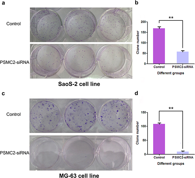 Impact of PSMC2 silencing on osteosarcoma cell colony formation.