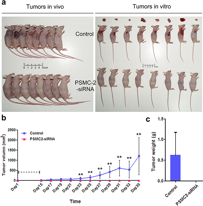 Knockdown of PSMC2 in SaoS-2 cells inhibited tumorigenicity in nude mice.