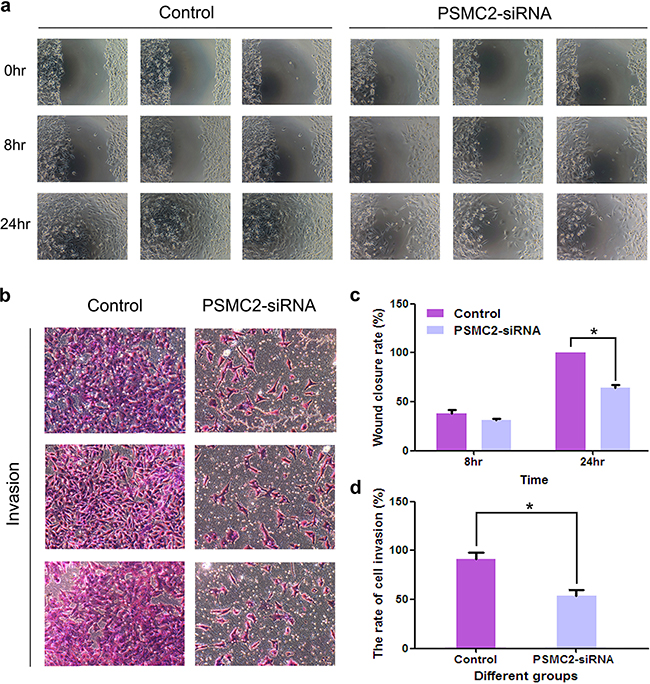 Effects of Silencing PSMC2 on migration and invasion in osteosarcoma cells.