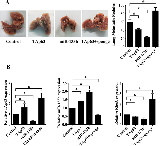 TAp63/miR-133b inhibits lung and liver metastasis.