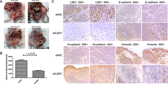 Effects of LSD1 knockdown on peritoneal disseminated tumor growth.