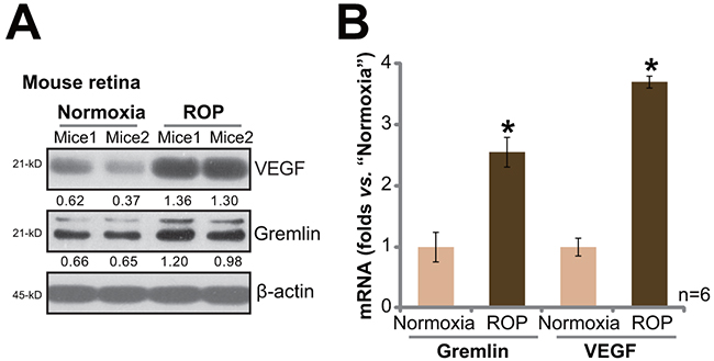 Upregulation of gremlin and VEGF in the retinas of retinopathy of prematurity (ROP) model mice.