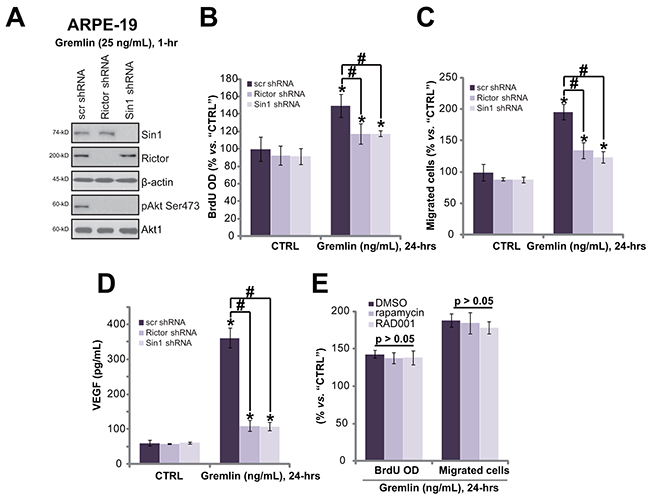 mTORC2 activation mediates gremlin-induced pleiotropic functions in RPE cells.