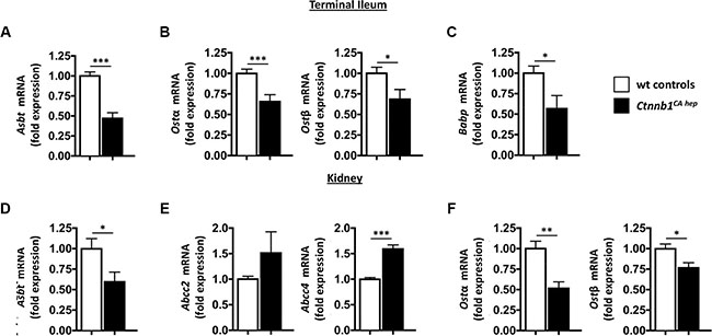 Cholestasis