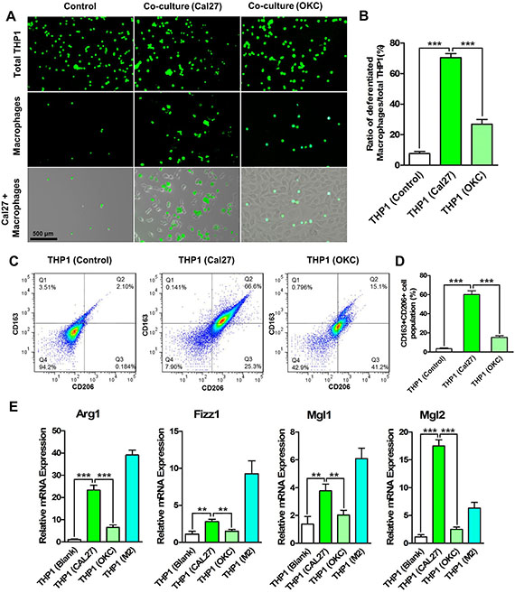 HNSCC cells promote the differentiation and M2- polarization of THP1 cells.