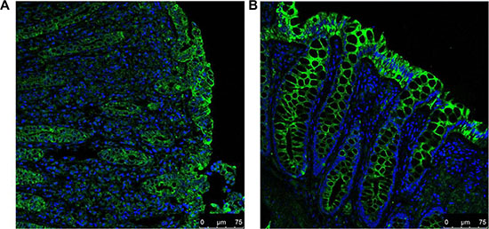 IF staining for A3AR (FITC; green) and counterstaining of nuclei (DAPI; blue) in UC (A) and normal (B) colonic tissues.
