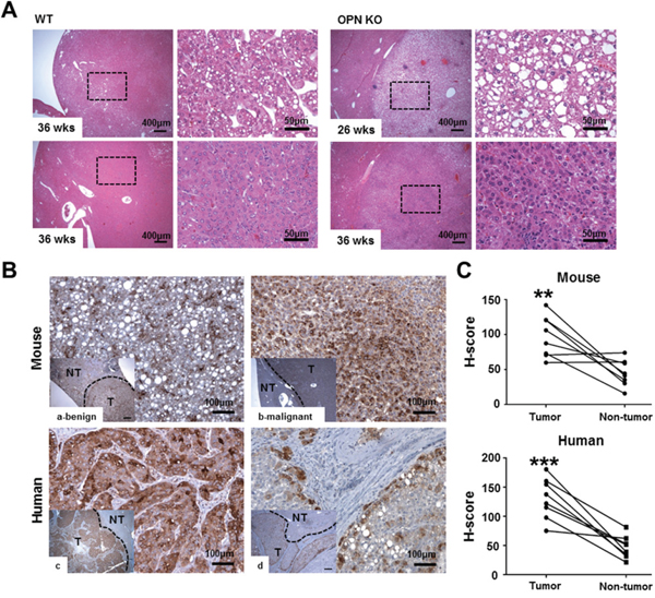 Histopathology and IHC for OPN.