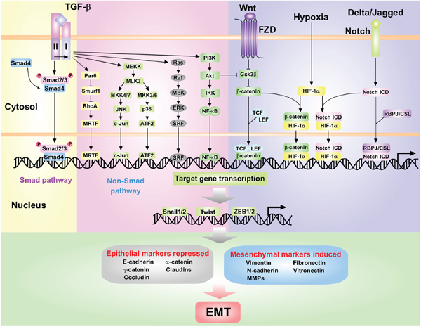 The dominating interconnected signaling pathways and transcriptional network that promote EMT during tumorigenesis.