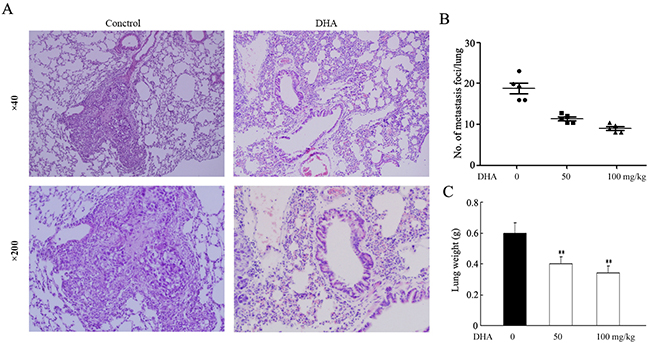 Effect of DHA on the metastasis of A549 in nude mice.
