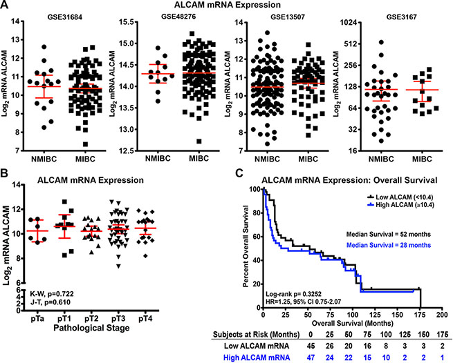 Correlation of ALCAM mRNA with tumor progression and overall survival in bladder cancer.