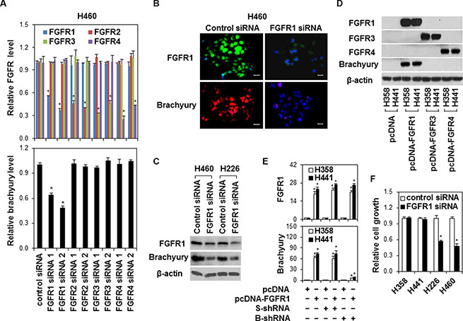 The regulation of brachyury by FGFR1 in lung cancer cells.