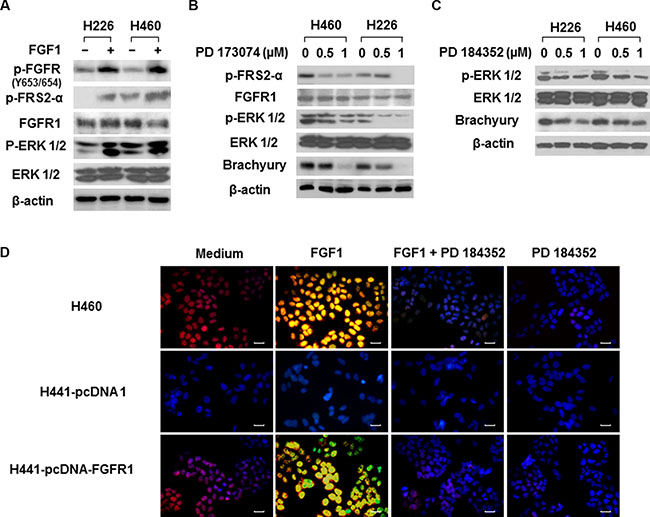 The MAPK-mediated regulation of FGFR1 on brachyury in lung cancer cells.
