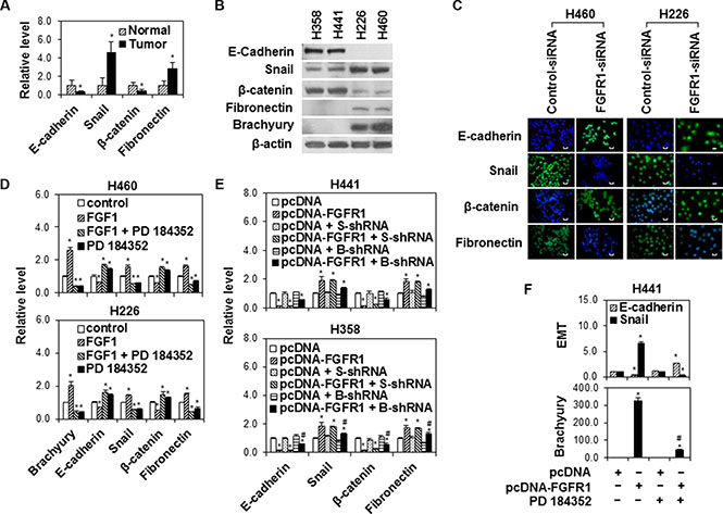 The modulation of brachyury-driven EMT by FGFR1/MAPK signaling in lung cancer cells.