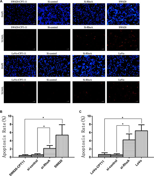 Inhibition of RhoA induces apoptosis in CPT-11-resistant CRC cells by TUNEL assay.