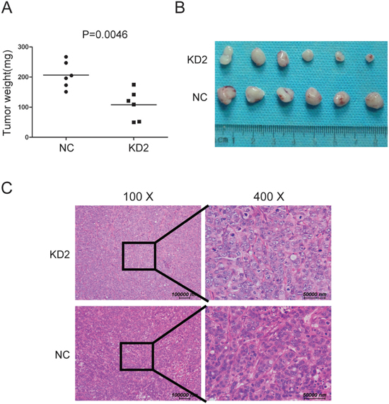 Silencing TRIM11 reduces tumor growth in vivo.