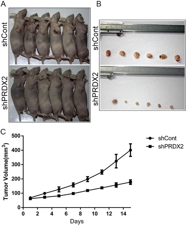 Prdx2 depletion inhibits tumor growth of colon cancer in vivo.
