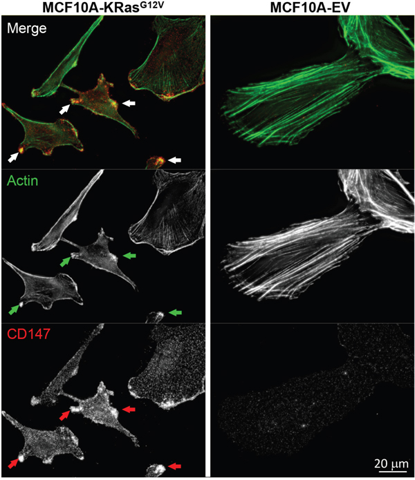 Redistribution of actin in MCF10A-KRasG12V cells.