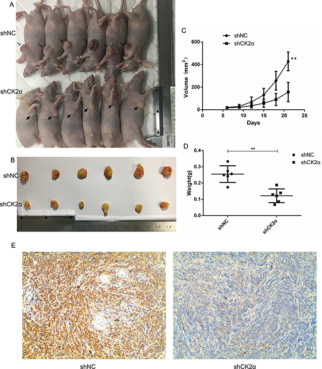 CK2&#x03B1; inhibition decreased tumorigenesis and reduced cancer cell growth in vivo.