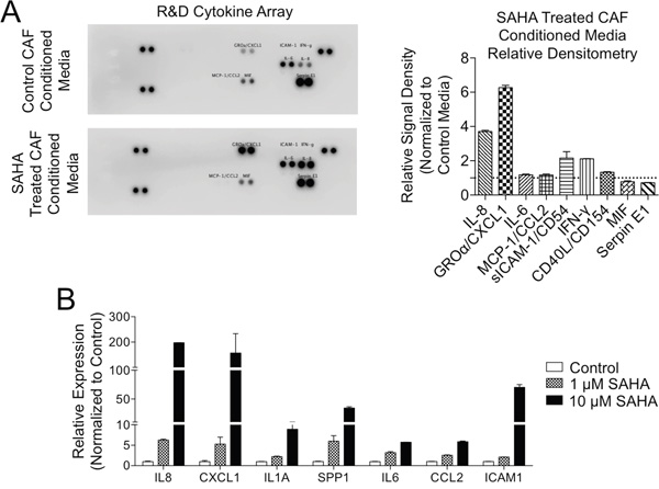 HDACi treatment increases secretion of tumor supportive pro-inflammatory mediators in PDAC CAFs.