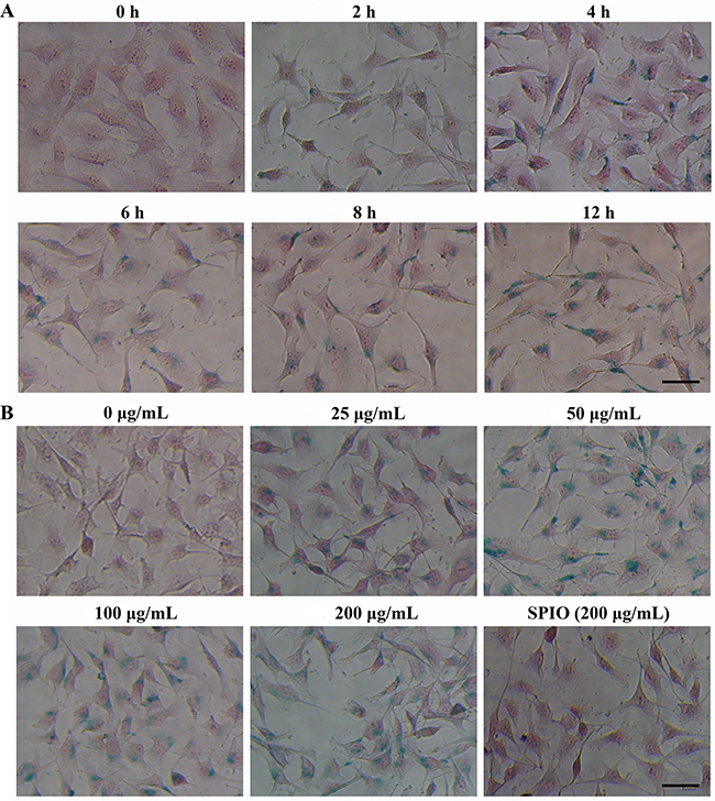 Prussian blue-stained and nucleus fast red-counterstained T24 cells incubated with SPIO-R11 or SPIO.