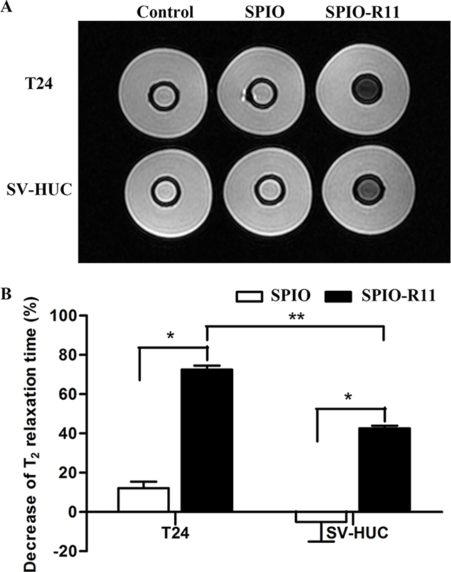 A. T2-weighted MR image of cells in gelatin (5&#x00D7;106 cells/mL) before and after 4 h incubation with SPIO and SPIO-R11 (50 &#x03BC;g/mL of Fe concentration).