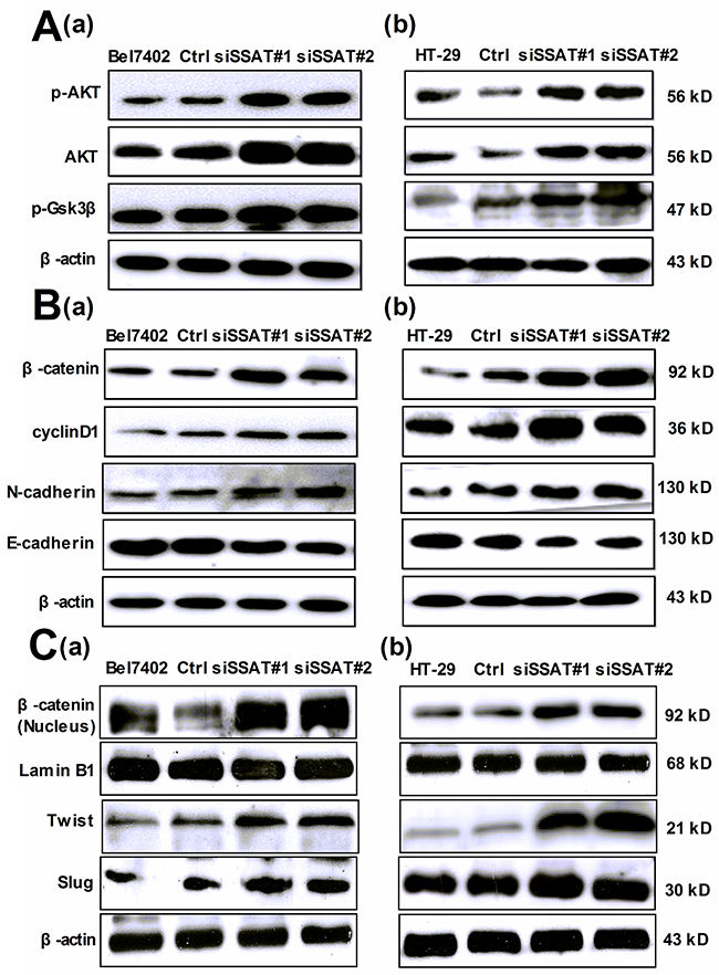 Silencing of SSAT induced AKT/GSK3&#x03B2;/&#x03B2;-catenin signaling pathway and Epithelial-to-Mesenchymal transition in hepatocellular and colorectal carcinoma cells.