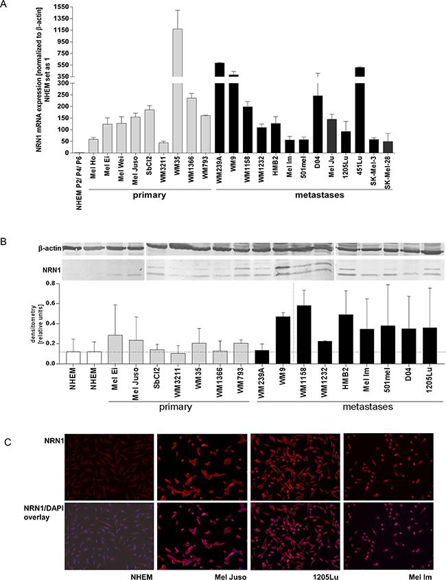 NRN1 expression in melanoma cell lines.