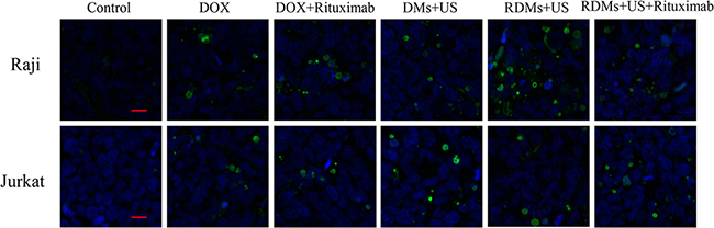 TUNEL staining of Raji and Jurkat lymphomas treated with different formulations.