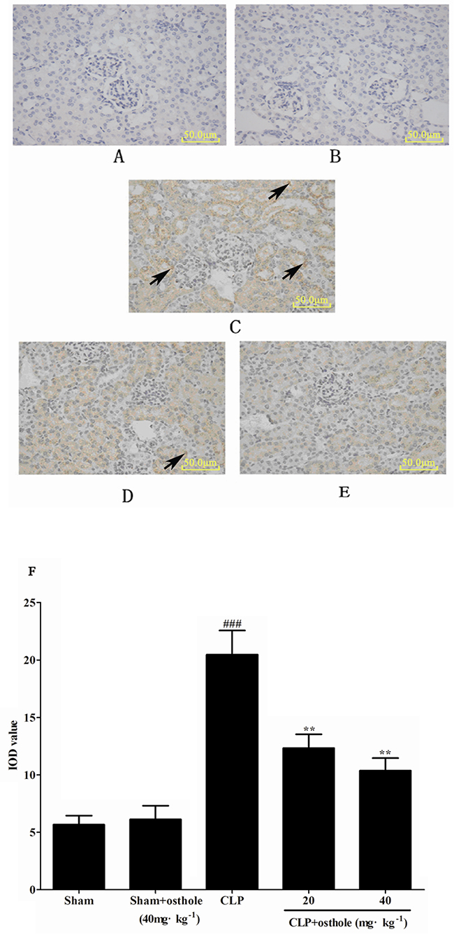 The effect of osthole on phospho-NF-&#x03BA;B p65 localization and expression in kidney tissue by immunohistochemistry (magnification&#x00D7;100).