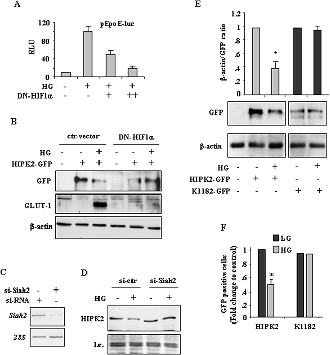 HIF-1 activity is involved in HIPK2 degradation in HG condition.