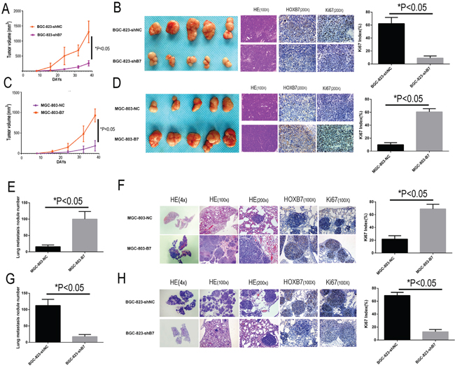 HOXB7 expression promotes tumorigenesis and lung metastasis in subcutaneous implantation and tail vein injection models.
