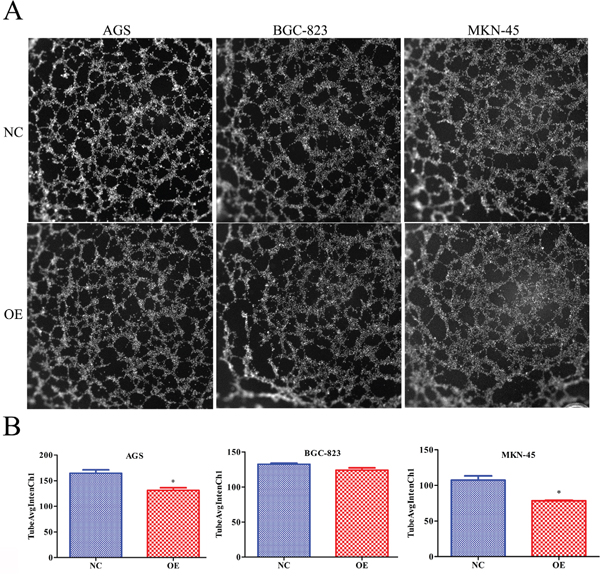 Overexpression of RBMS3 inhibited the angiogenesis of gastric cancer cell.