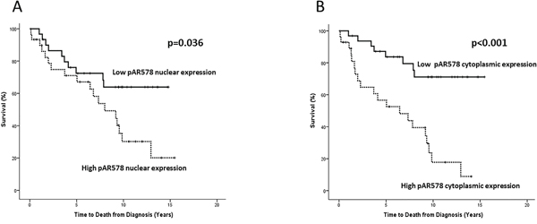 Kaplan-Meier survival plots illustrating disease-specific survival in patients with high (dashed line) and low (solid line) nuclear A. and cytoplasmic B. pARS578 expression.