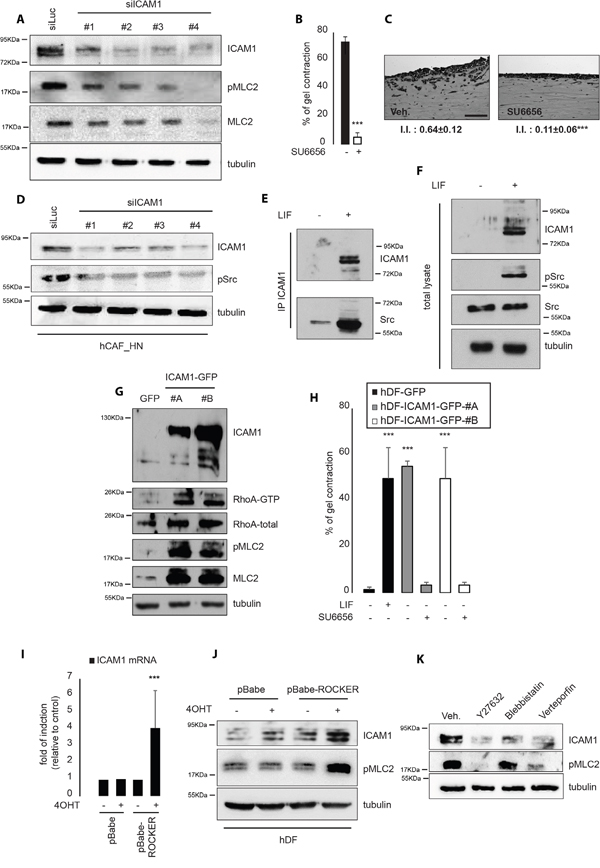 ICAM-1 regulates and is regulated by acto-myosin contractility.