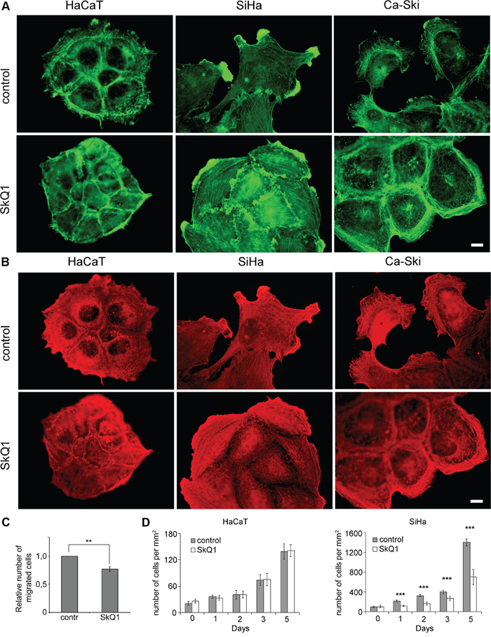 SkQ1 induced reorganization of cytoplasmic actins and inhibited proliferation of cervical cancer cells.